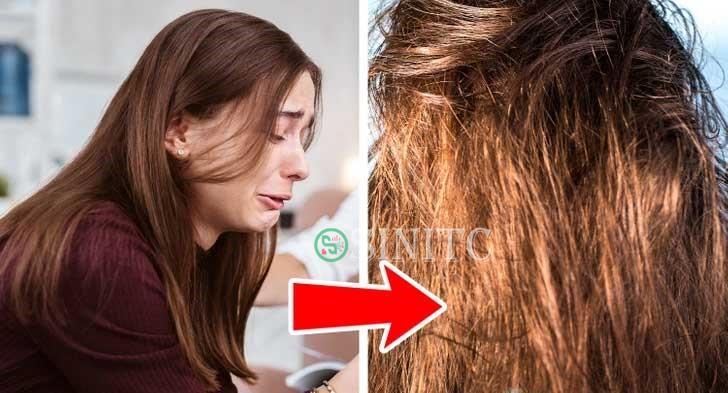 Căng thẳng quá mức cũng khiến tóc tiết dầu nhiều