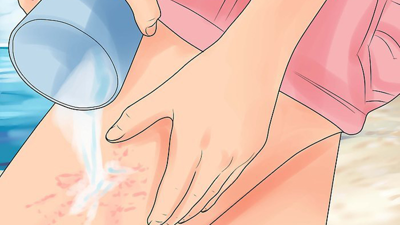 Nhanh chóng rửa sạch vết thương