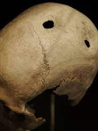 Hộp sọ của một người đàn ông có thể 21-35 tuổi, có niên đại khoảng 3500-3400 TCN